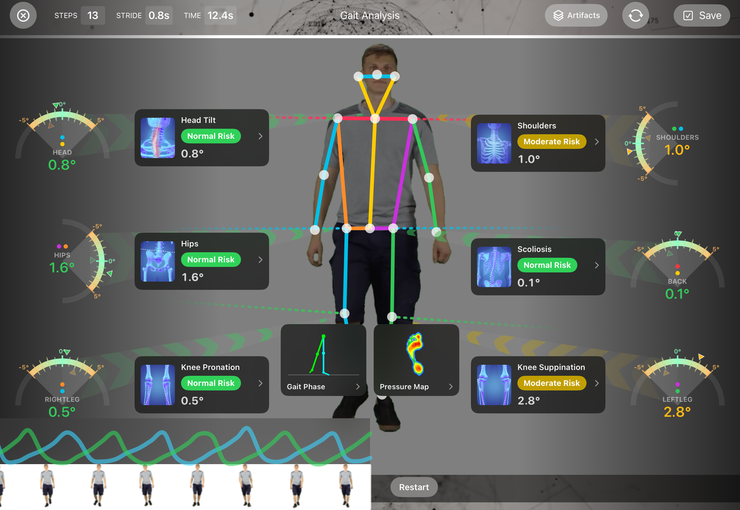 Gait analysis overview with risk-graded joint angles in FitsPro