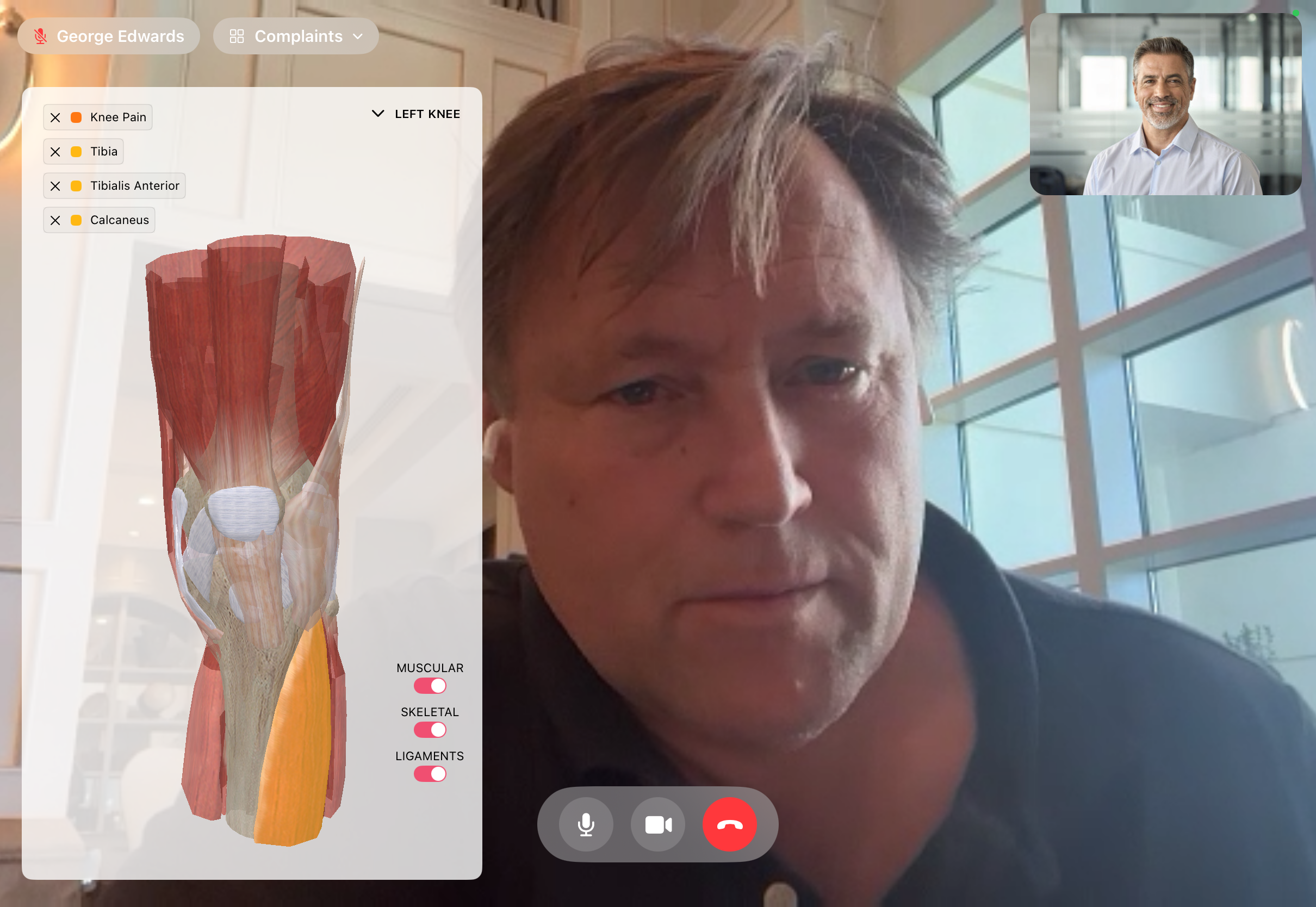 Live telehealth session with patient video and on-screen knee anatomy in FitsPro